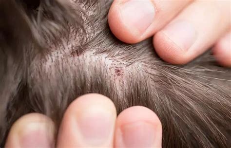 How To Treat Scabs On The Scalp