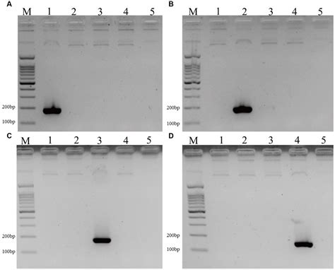 Frontiers Increased Diversity Of Malassezia Species On The Skin Of