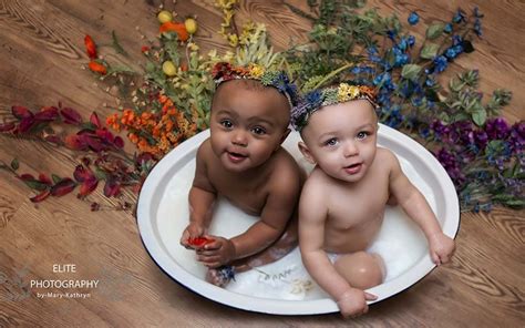 These Twin Babies Were Born With Different Skin Colors Readers Digest