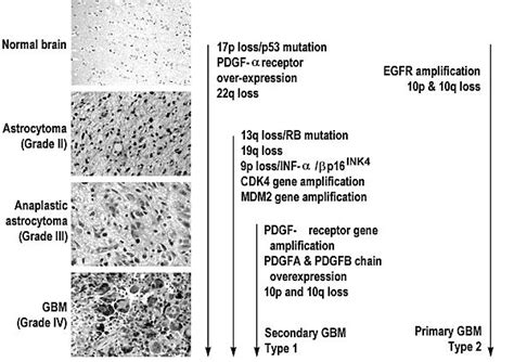 Genetics Of Adult Malignant Gliomas