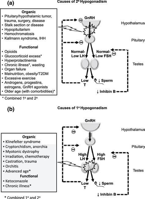 Causes of hypogonadism. (a) Causes of secondary hypogonadism. (b ...