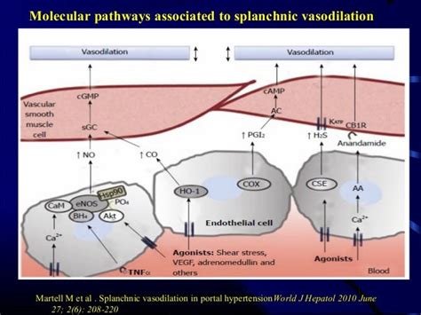 Portal Hypertension Classification And Pathophysiology 50a