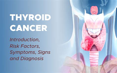 Thyroid Cancer Gynecoloncol