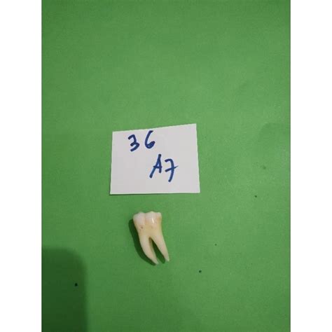 Jual Gigi 36 A7 Gigi Molar 1 Kiri Bawah Shopee Indonesia