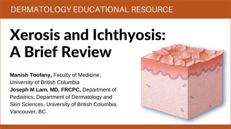 Xerosis And Ichthyosis A Brief Review Healthplexus Net