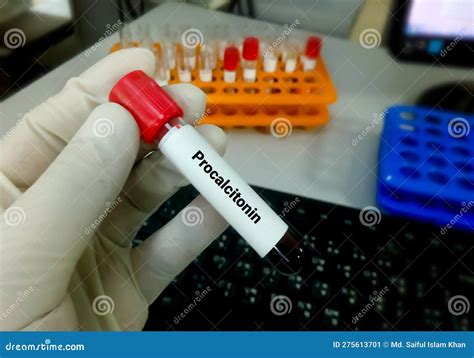 Procalcitonin Pct Test Diagnosis Of Severe Sepsis Stock Image