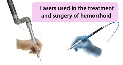 Hemorrhoid Laser Dr Zahra Saadati Laser Surgery