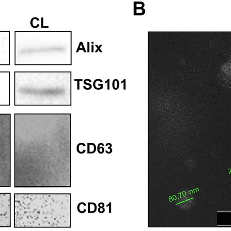 Identification Of Evs Released From U Mg By Western Blotting And Sem