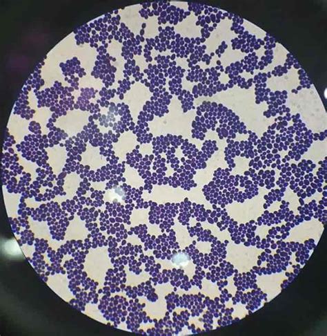 Comparar intersección Perspectiva candida albicans al microscopio Color