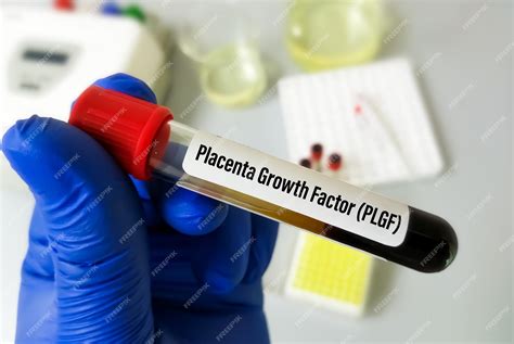 Premium Photo Blood Sample For Placental Growth Factor Or Pigf Test