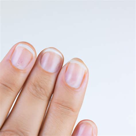 What Does Your Nails Say About Your Health The Enlightened Mindset