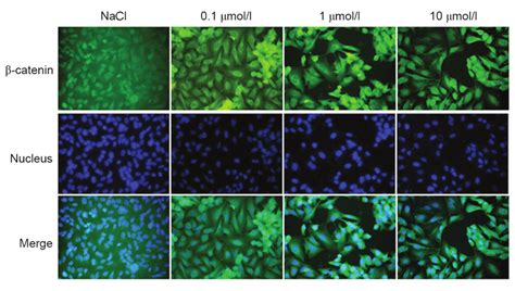 Localization Of β Catenin Immunofluorescence In Response To Treatment