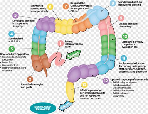 Cono Salud Cirug A Colorrectal Intestino Grueso C Ncer Colorrectal