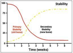 Primary Stability Comes With Old Bone Secondary Stability Comes With