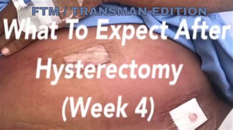 What To Expect After Hysterectomy Week 4 Youtube