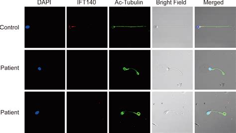 Immunofluorescence Staining Of The Spermatozoa Of A Normal Person And Download Scientific