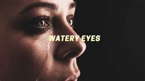 Watery Eyes: Understanding Causes, Symptoms, and Treatment