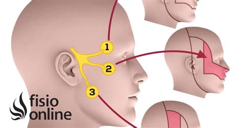 Neurálgia Del Trigémino Qué Es Causas Síntomas Y Tratamiento