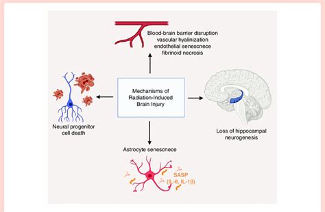 Mechanisms of radiation-induced brain injury. Vascular changes ...