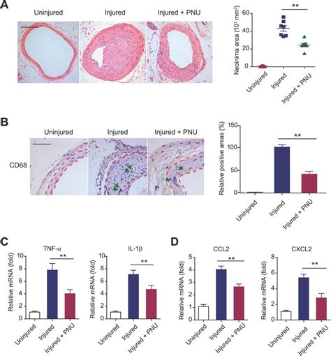 Activation Of Cap Inhibits Neointimal Hyperplasia And Inflammation