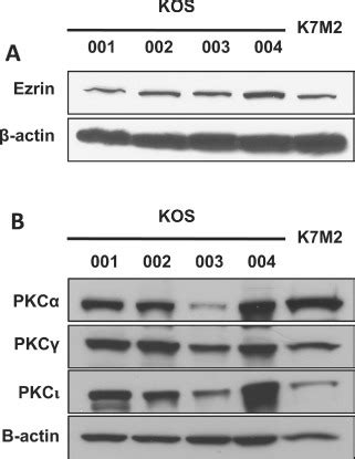 Ezrin And Pkc Were Expressed In All Of Canine Osteosarcoma Os Cells