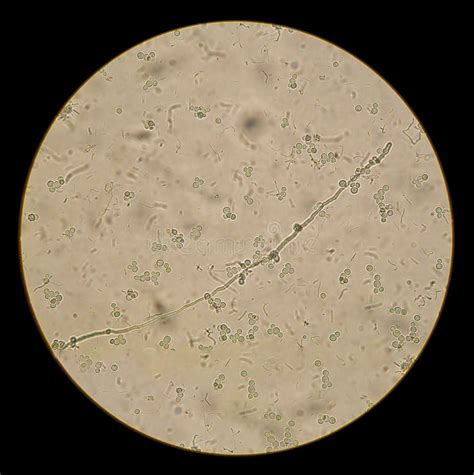 149 Candida Albicans Microscope Stock Photos - Free & Royalty-Free Stock Photos from Dreamstime