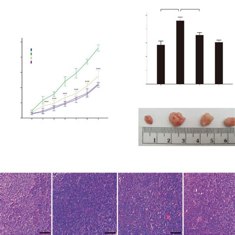 Tumor Growth In Nude Mice Under Hypoxic Condition Inhibition Of Fpr