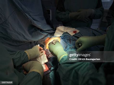 Heart Pacemaker Surgery Photos and Premium High Res Pictures - Getty Images