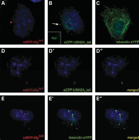 Centrosomal Localization Of Nlp IsoB USH2A Tail And Lebercilin In