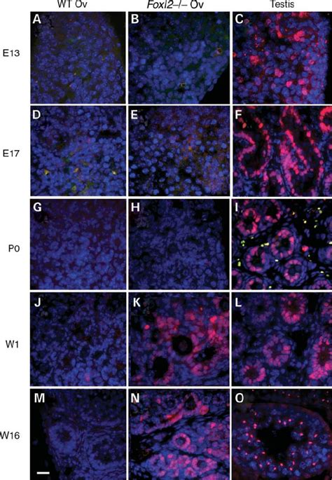 Immunohistochemical Detection Of Sox9 At High Magnification Showing Download Scientific Diagram