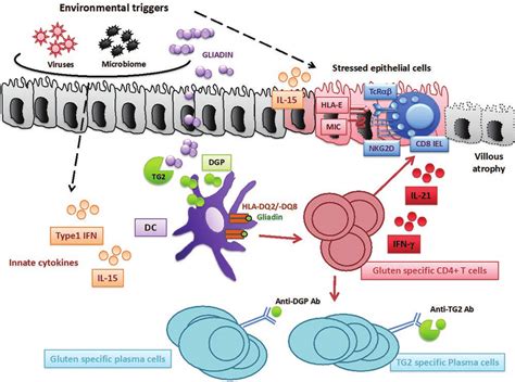 Cd Pathogenesis Celiac Disease Cd Is A Multifactorial Disorder