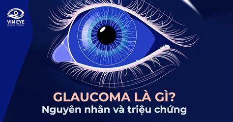 Glaucoma là gì Nguyên nhân và triệu chứng của cườm nước BỆNH VIỆN