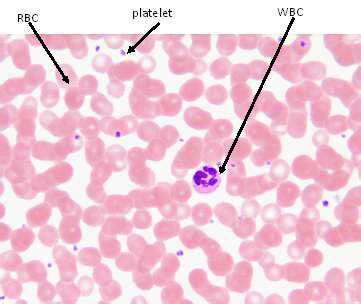 A Blood Smear That Shows The Composition Of RBCs WBCs And Platelets