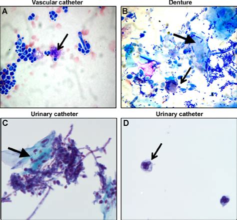 Host Cells Associate With C Albicans Biofilms In Vivo C Albicans Download Scientific