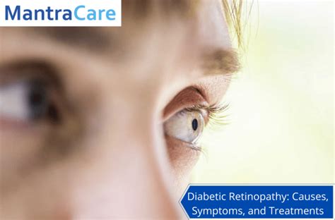 Diabetic Retinopathy: Causes, Symptoms, And Treatment