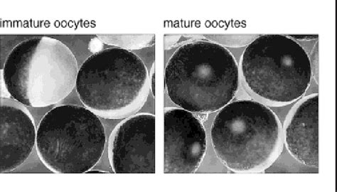 Xenopus Oocyte