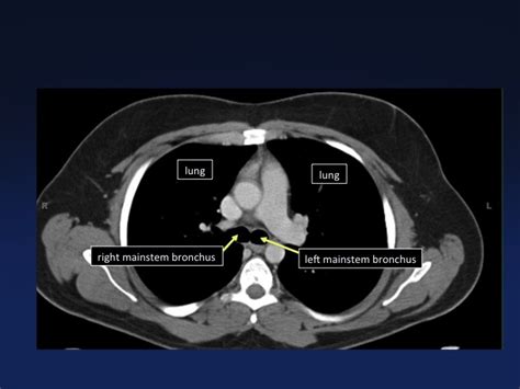 Cross Sectional Anatomy Of The Body Mdct Atlas Ct Scanning