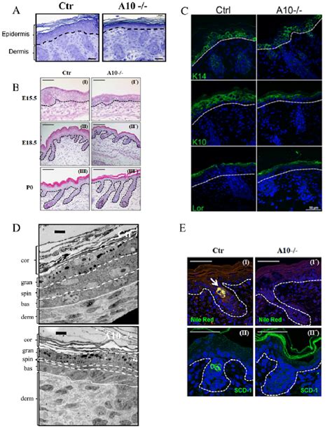 Histological And Ultrastructural Analysis Of Newborn Adam Deficient