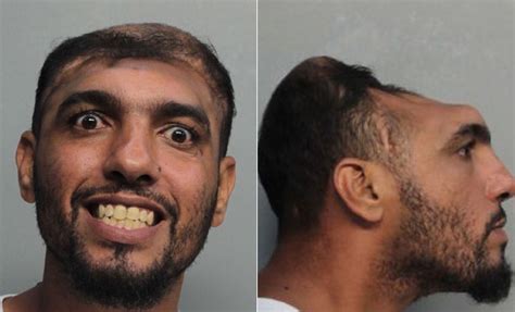 Half Headed Florida Man Arrested On Arson Attempted Murder Charges