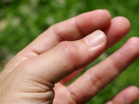 Pin on Health Conditions and Tips