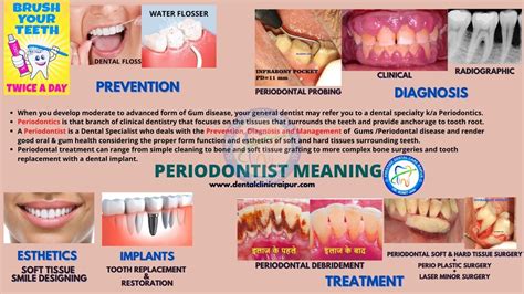 Periodontitis Archives Prestige Dental Care