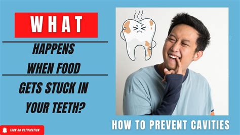 What Happens When You Get Food Stuck In Your Teeth Tips From Dr