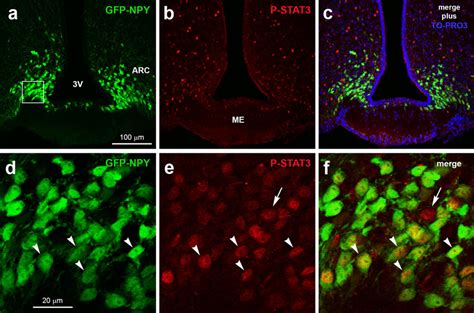 Leptin Dependent Jak2 Stat3 Signalling Activation In Hypothalamic Arc Download Scientific