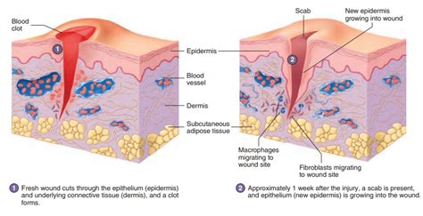 Tissue Repair