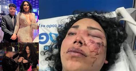 Paola Suárez podría perder un ojo tras supuesta agresión de su