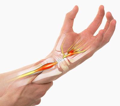 Diagnosis Of Nerve Conditions Thames Shoulder Elbow London