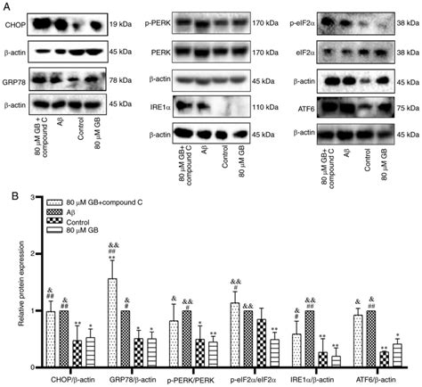 Ginkgolide Binduced Ampk Pathway Activation Protects Astrocytes By