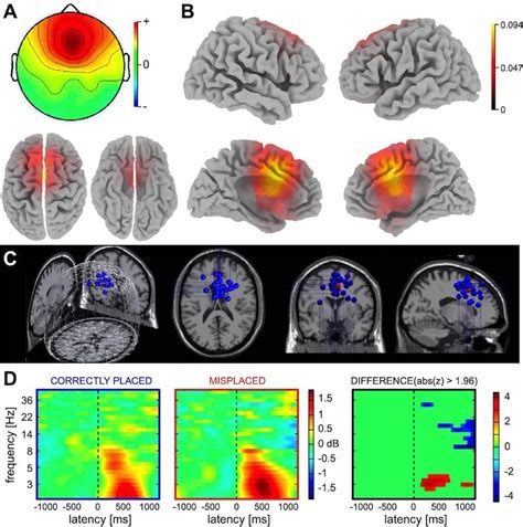 Basics Of Eeg Data Collection Processing Analysis Imotions