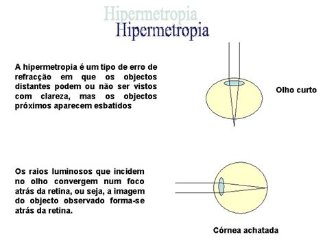 Funcionamento Do Olho Humano Retina Nervo Ptico Olho