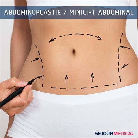 Quelle Est La Diff Rence Entre Une Abdominoplastie Et Le Minilift